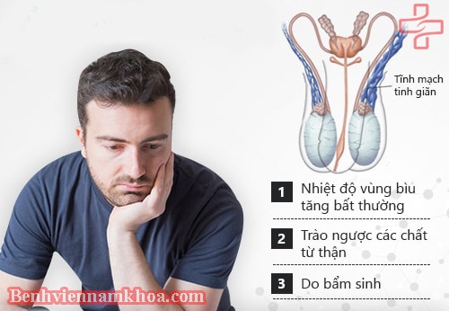 Giãn tĩnh mạch thừng tinh có nguy hiểm không