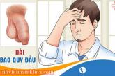 Hình ảnh dài bao quy đầu