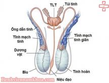 Nguyên nhân gây giãn tĩnh mạch thừng tinh