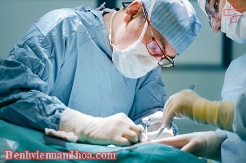 Những nguyên tắc chung khi tiến hành mổ giãn tĩnh mạch thừng tinh