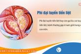 Phì đại tuyến tiền liệt là gì