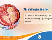 Phì đại tuyến tiền liệt là gì