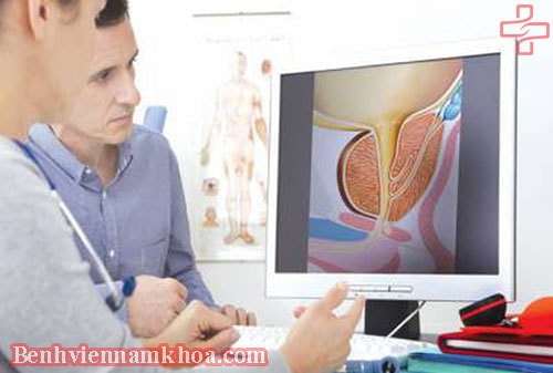 Phương pháp điều trị bệnh phì đại tuyến tiền liệt ở nam giới