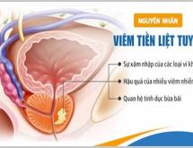 Bệnh viêm tuyến tiền liệt là gì