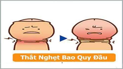 Nghẹt bao quy đầu