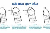 dài bao quy đầu