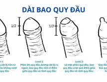 dài bao quy đầu