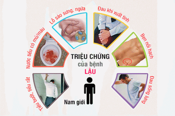 triệu chứng bệnh lậu